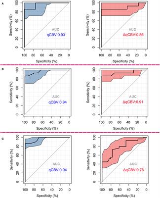 Quantitative MR Perfusion for the Differentiation of Recurrence and Radionecrosis in Hypoperfusion and Hyperperfusion Brain Metastases After Gamma Knife Radiosurgery